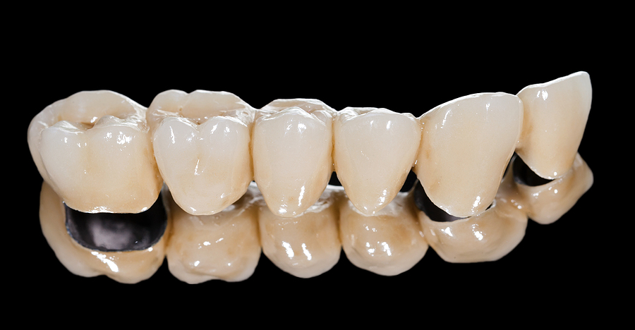 Restore Your Smile with Durable and Natural-Looking Dental Bridges