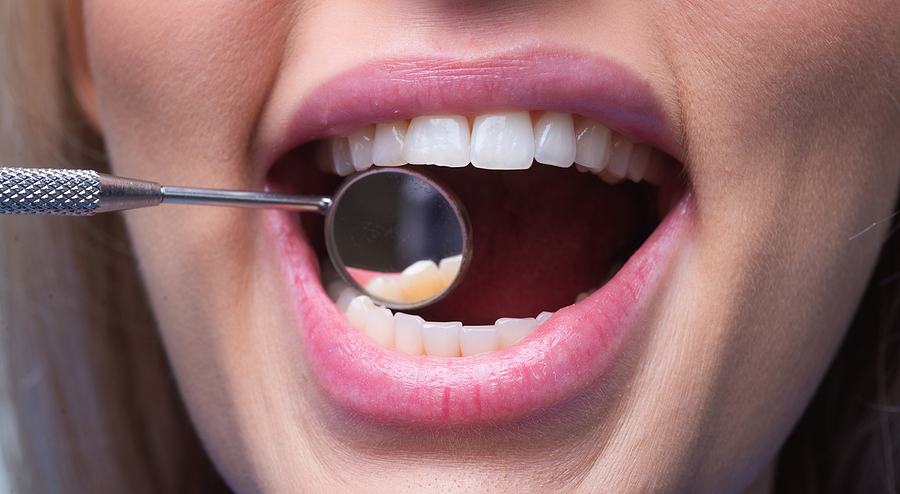 How Dental Bridges Restore Your Smile and Improve Chewing Ability