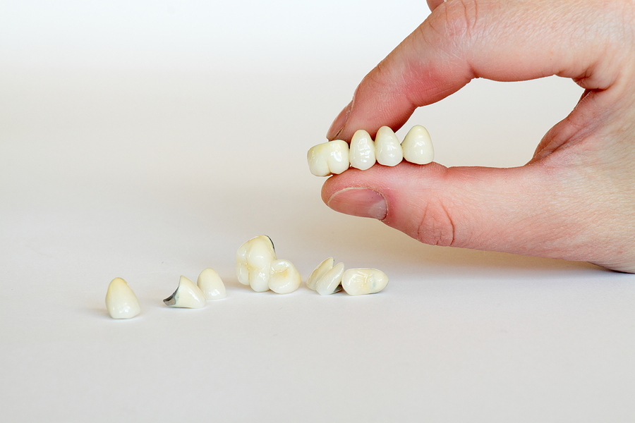 Restore Your Smile with Porcelain Dental Crowns in Spring, TX
